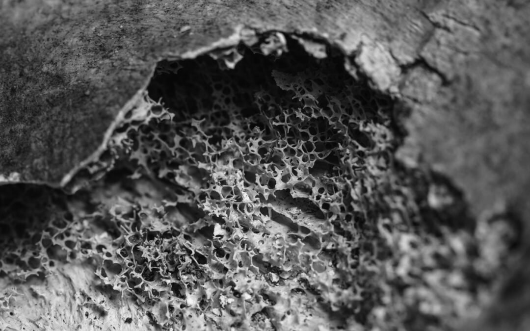 How To Increase Bone Density