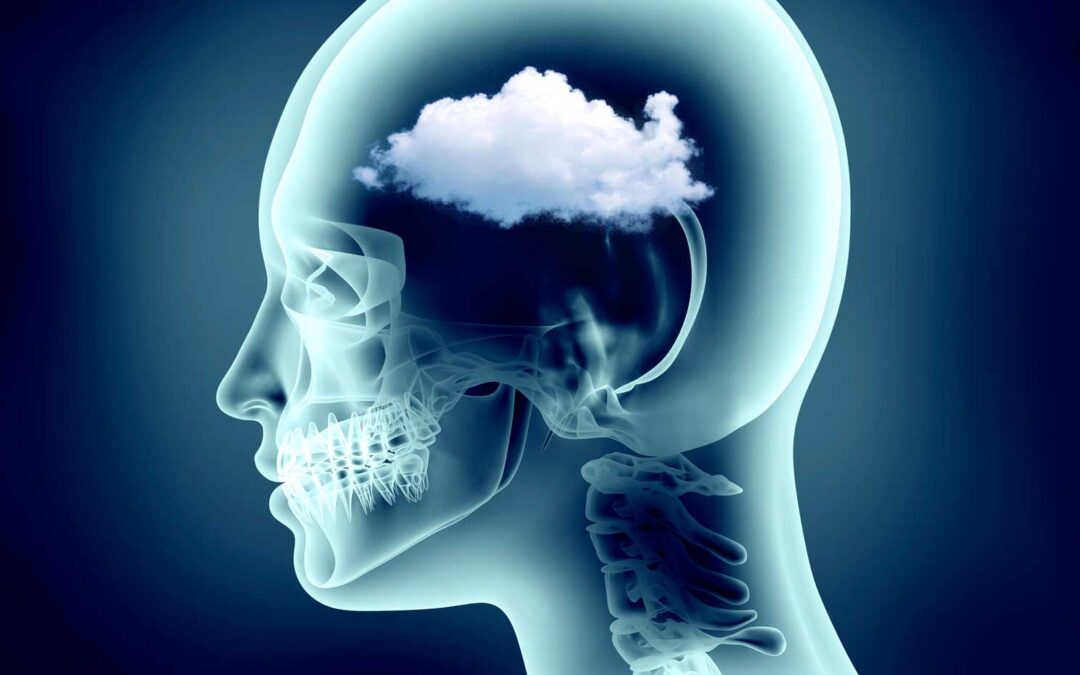 Brain fog and how to avoid it